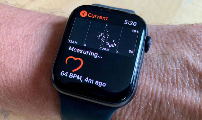 Ожидается новая «медицинская» функция Apple Watch